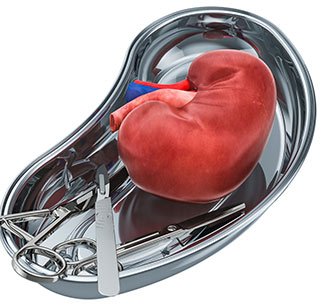 Renal-transplant-surgery